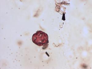 Myosotis ramosissima pollen