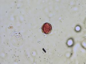 Lepidium draba pollen