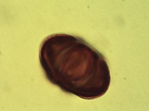 Pollen from the plant Genus Rauvolfia.