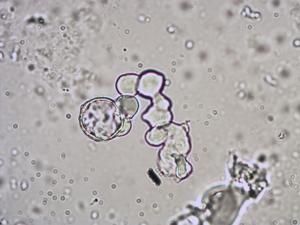Oxyria digyna pollen