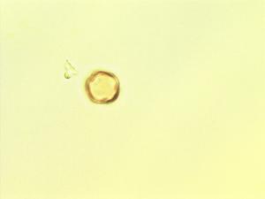 Pterocarpus rotundifolius pollen