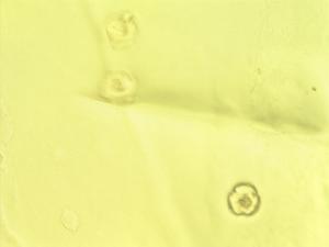 Brachylaena discolor pollen
