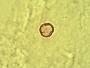 Phyllanthus reticulatus pollen