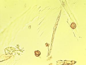 Aeonium canariense pollen