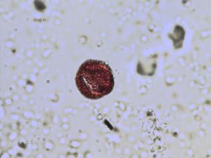 Pollen from the plant Genus Cakile.