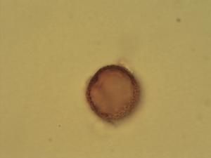 Rumex thyrsiflorus pollen