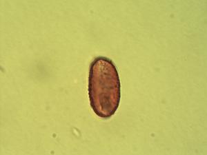 Aneilema lanceolatum pollen