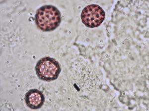 Chenopodium ficifolium pollen