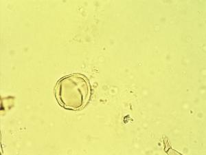 Pollen from the plant Genus Capraria.