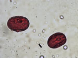 Lathyrus japonicus pollen
