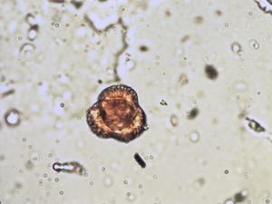 Lomatogonium pollen
