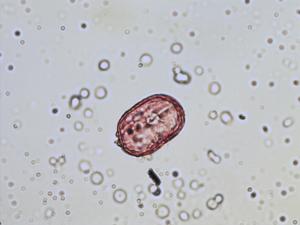 Lathyrus vernus pollen