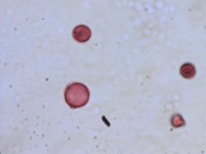 Pedicularis comosa pollen