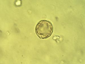 Alchornea cordifolia pollen