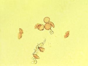 Smilax pollen
