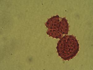 Pollen from the plant Genus Baccharis.