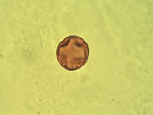 Alchornea laxiflora pollen