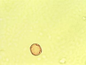 Acalypha aronioides pollen