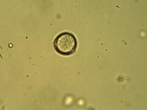Cistus incanus pollen
