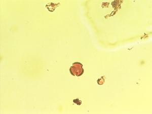 Plocama pendula pollen