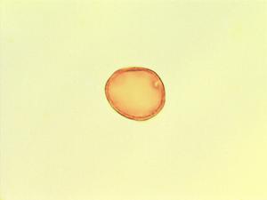 Celtis mildbraedii pollen