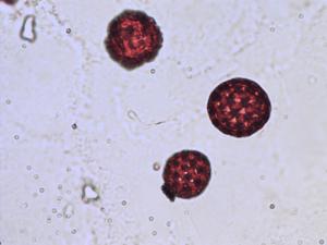 Atriplex pedunculata pollen