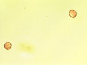 Cytisus pollen