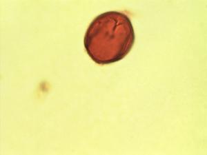 Piscidia carthagenensis pollen