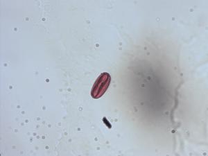 Pollen from the plant Genus Begonia.