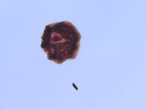 Taraxacum campylodes pollen