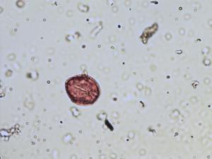 Astragalus glycyphyllos pollen