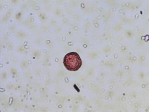 Nasturtium microphyllum pollen
