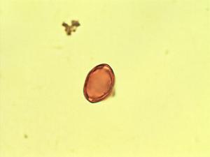 Psidium galapagaeum pollen