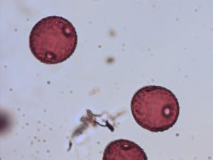 Phyteuma orbiculare pollen
