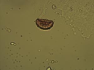 Asplenium sulcatum pollen
