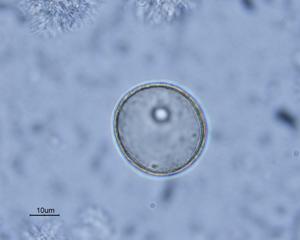 Pollen from the plant Genus Aira.