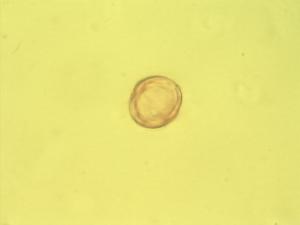 Breonadia salicina pollen