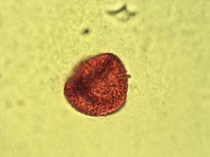 Ranunculus flagelliformis pollen