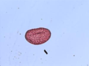 Polypodium platylepis pollen