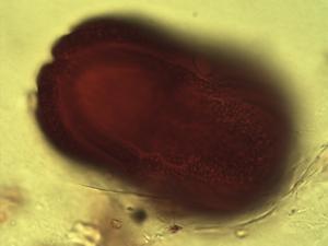 Pollen from the plant Genus Asystasia.