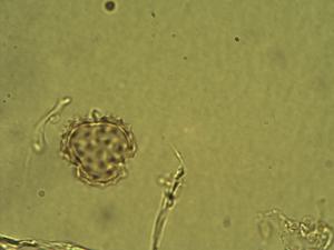 Jaegeria gracilis pollen
