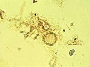 Spermacoce dispersa pollen