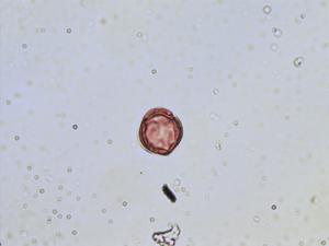 Dryas octopetala pollen