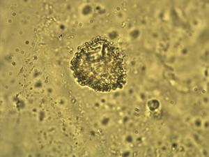 Lycopodium alpinum pollen
