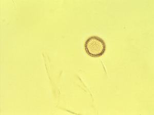 Menispermaceae pollen