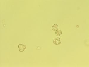 Artemisia tanacetifolia pollen