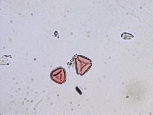 Thesium alpinum pollen