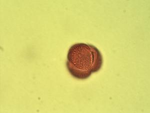 Gymnosporia senegalensis pollen