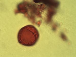 Trichoscypha pollen