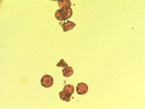 Pollen from the plant Genus Bosea.